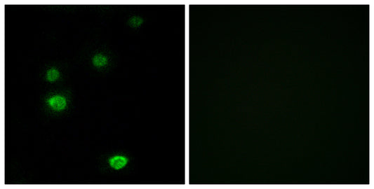 POLR3E Rabbit Polyclonal Antibody