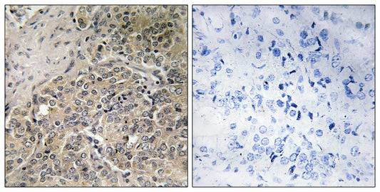 POTE14/22 Rabbit Polyclonal Antibody
