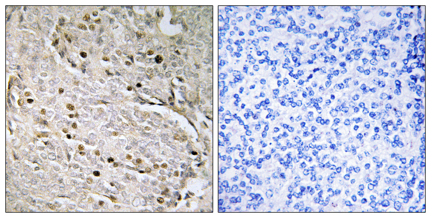 POTE-8 Rabbit Polyclonal Antibody