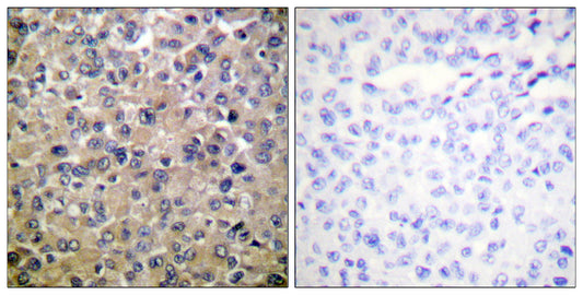 PP1α Rabbit Polyclonal Antibody