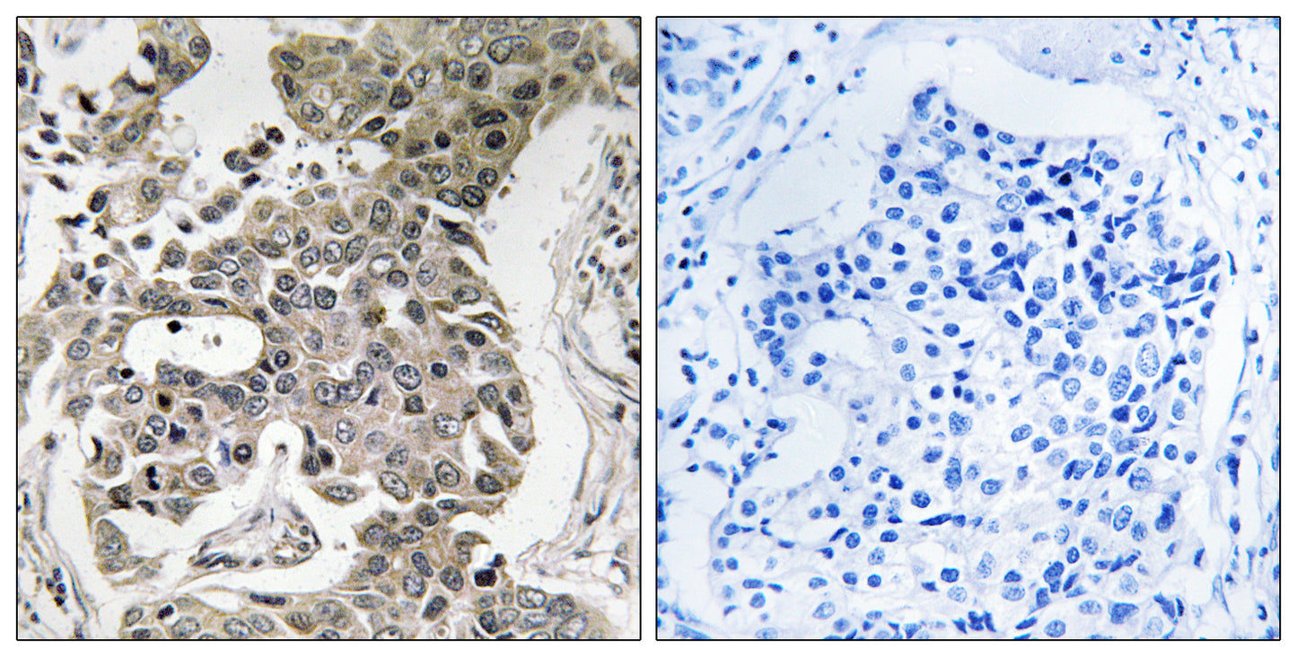 PP2A-Aβ Rabbit Polyclonal Antibody