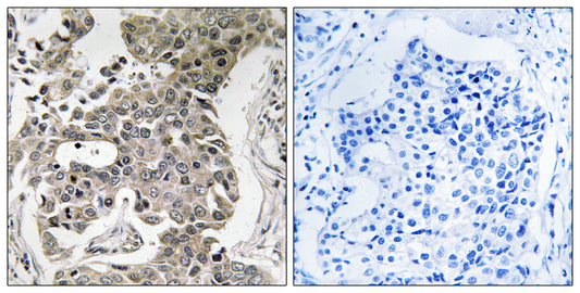 PP2A-Aβ Rabbit Polyclonal Antibody
