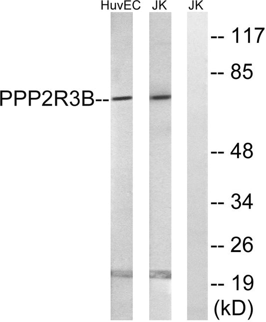 PP2A-B56-δ Rabbit Polyclonal Antibody