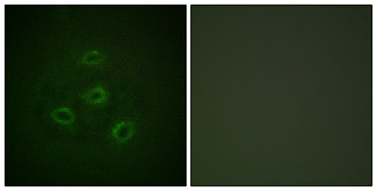 PP2A-Cα Rabbit Polyclonal Antibody