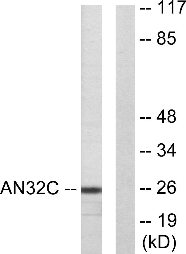 PP32R1 Rabbit Polyclonal Antibody