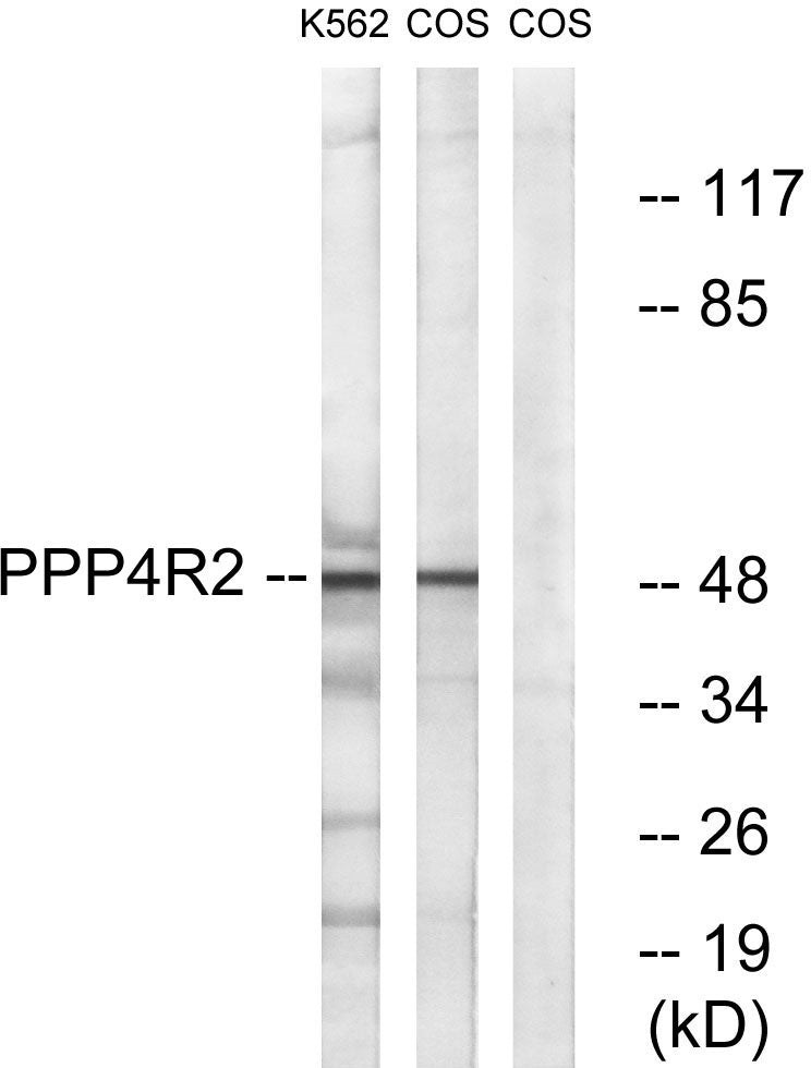 PP4R2 Rabbit Polyclonal Antibody