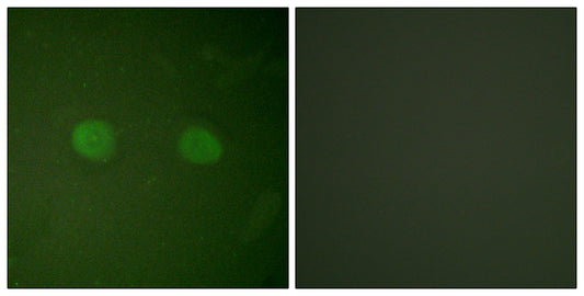PPAR-α Rabbit Polyclonal Antibody
