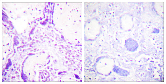 PPAR-γ Rabbit Polyclonal Antibody