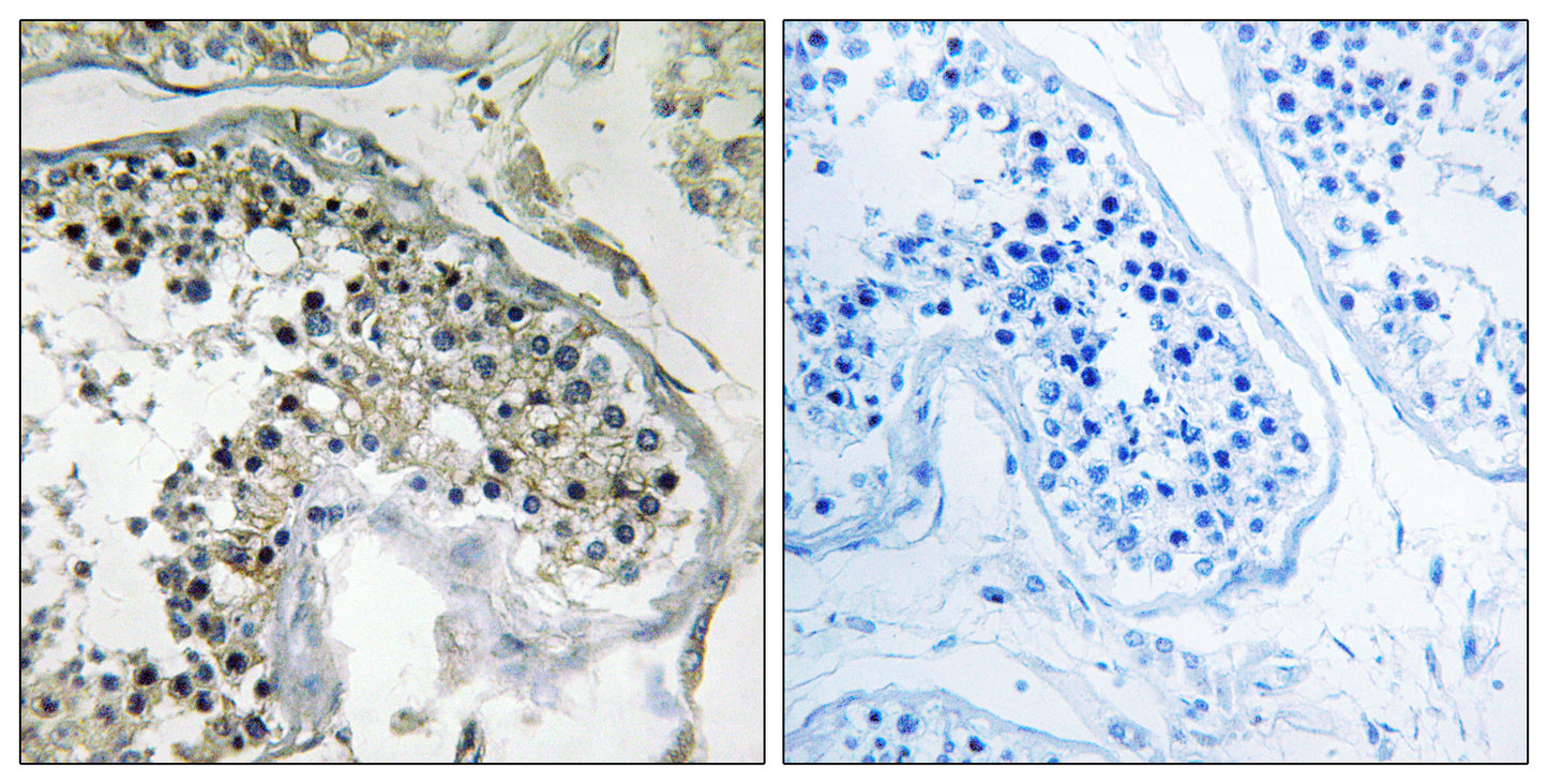 PPP1R1C Rabbit Polyclonal Antibody