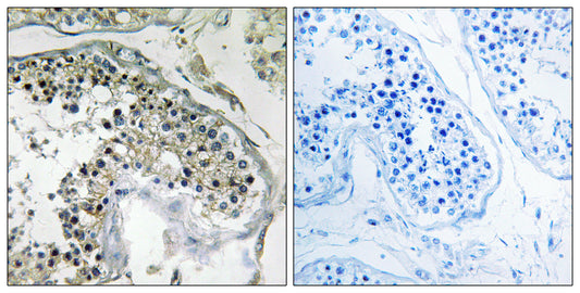 PPP1R1C Rabbit Polyclonal Antibody