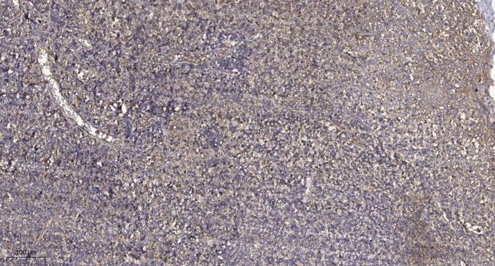 PPP1R2P3 Rabbit Polyclonal Antibody