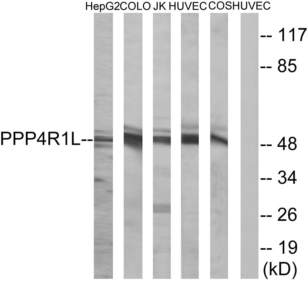 PPP4R1L Rabbit Polyclonal Antibody