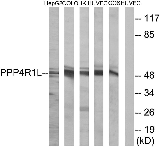 PPP4R1L Rabbit Polyclonal Antibody