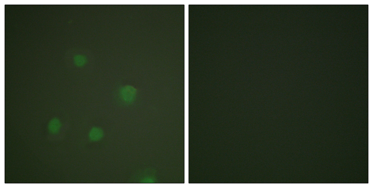 PR Rabbit Polyclonal Antibody