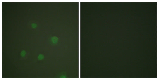 PR Rabbit Polyclonal Antibody