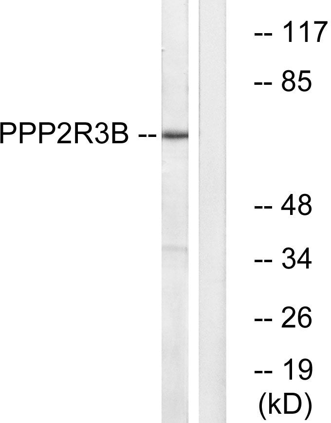 PR48 Rabbit Polyclonal Antibody