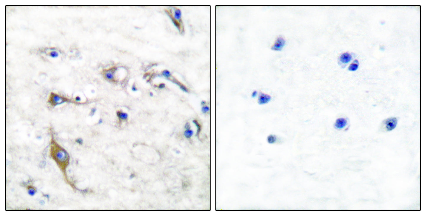 PRAF2 Rabbit Polyclonal Antibody