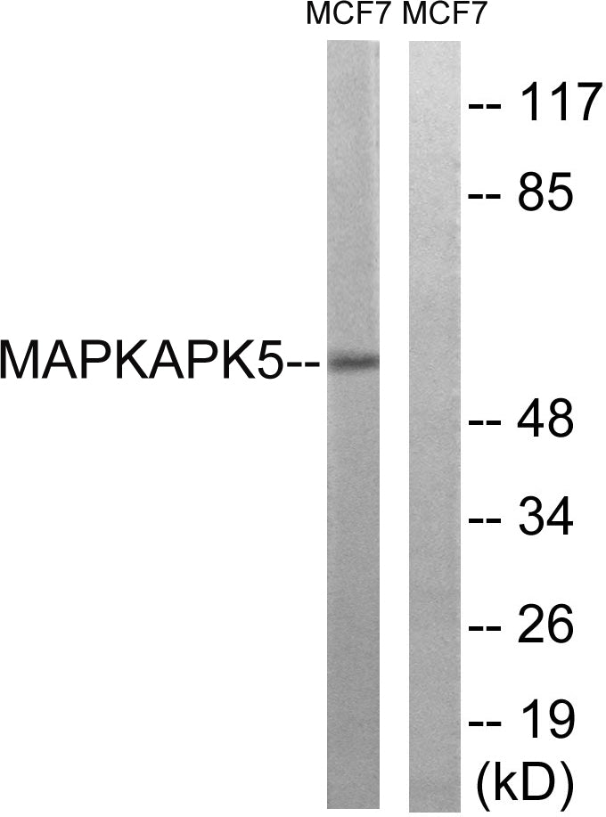 PRAK Rabbit Polyclonal Antibody