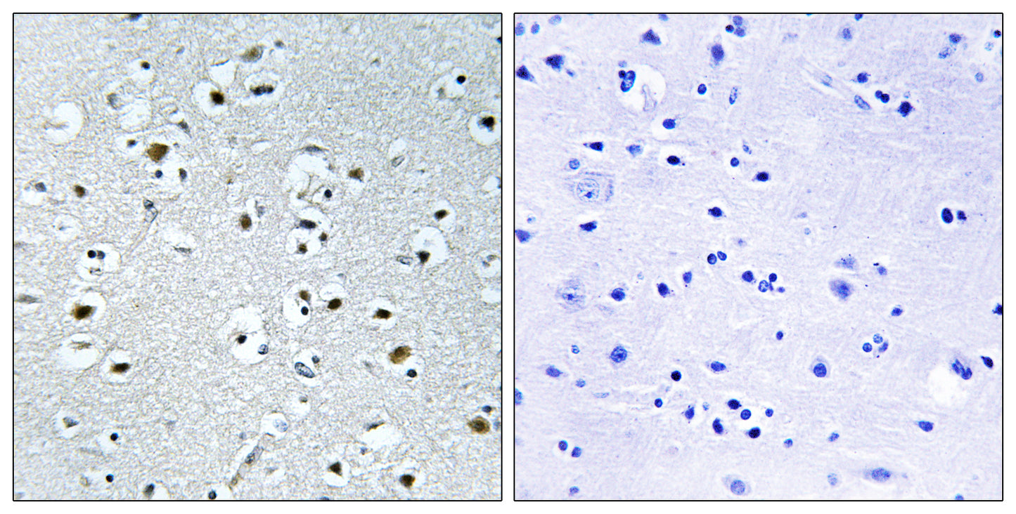 PRC Rabbit Polyclonal Antibody