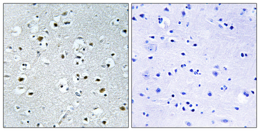 PRC Rabbit Polyclonal Antibody