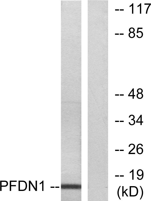 Prefoldin 1 Rabbit Polyclonal Antibody