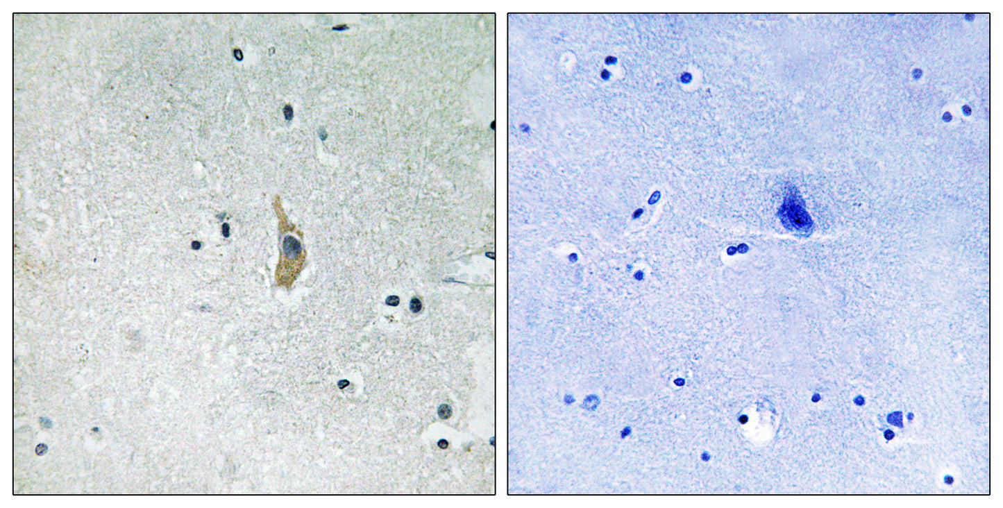 Presenilin 1 Rabbit Polyclonal Antibody