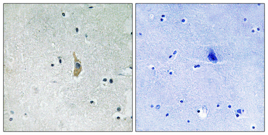 Presenilin 1 Rabbit Polyclonal Antibody