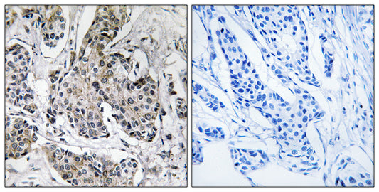 PRKX Rabbit Polyclonal Antibody