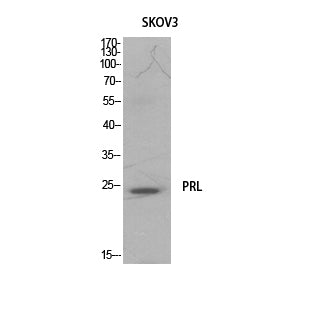 Prolactin Rabbit Polyclonal Antibody
