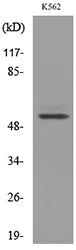 Protein C Rabbit Polyclonal Antibody