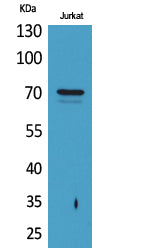 Prothrombin Rabbit Polyclonal Antibody