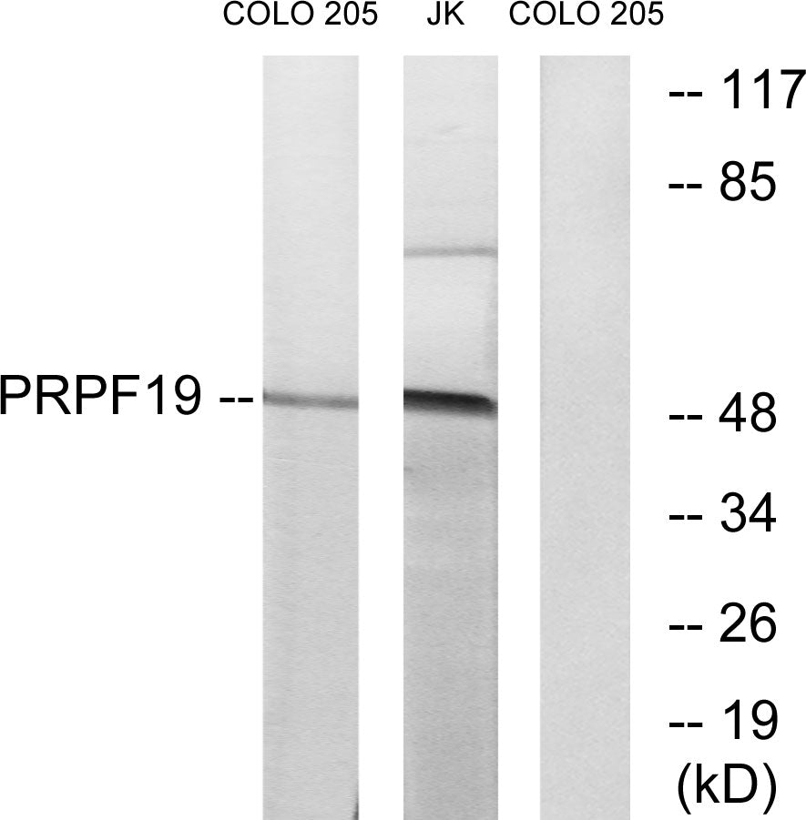 PRP19 Rabbit Polyclonal Antibody