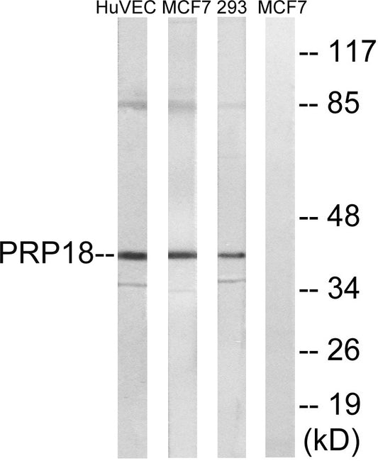 PRPF18 Rabbit Polyclonal Antibody