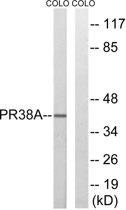 PRPF38A Rabbit Polyclonal Antibody