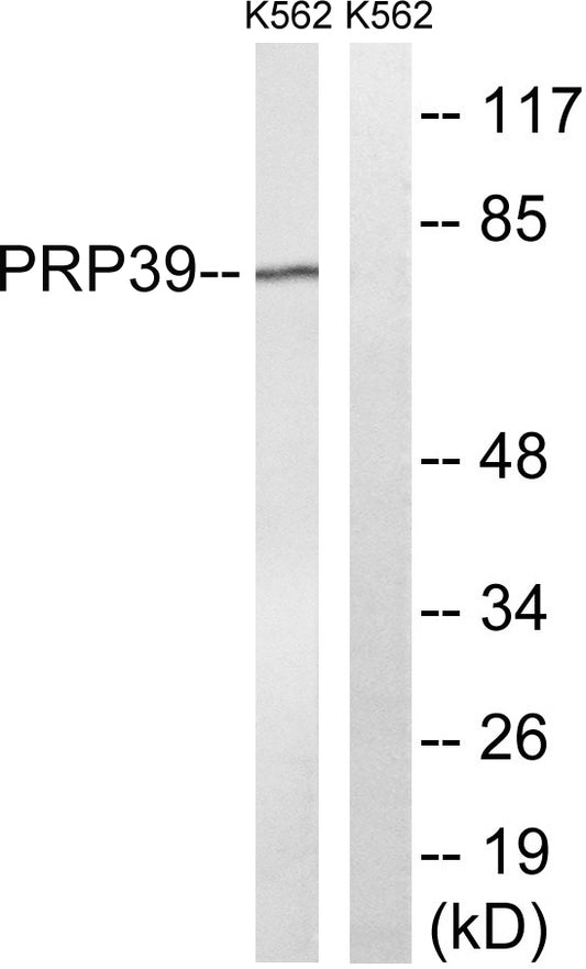 PRPF39 Rabbit Polyclonal Antibody