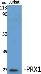 PRX1 Rabbit Polyclonal Antibody