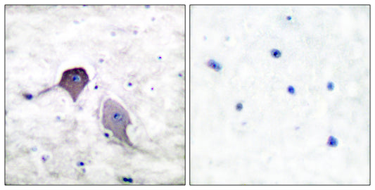 PS-1 Rabbit Polyclonal Antibody
