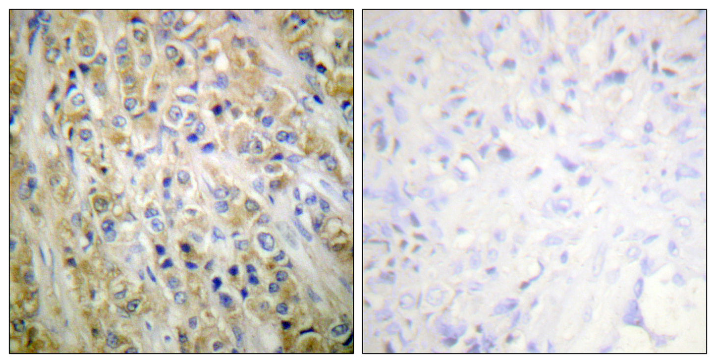 PSA Rabbit Polyclonal Antibody