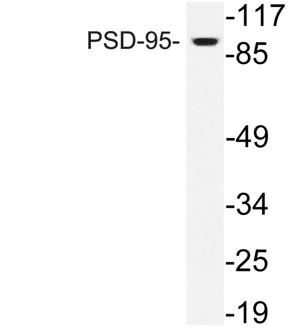 PSD-95 Rabbit Polyclonal Antibody