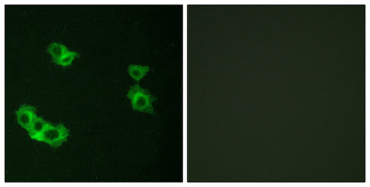 PTH/PTHrP-R Rabbit Polyclonal Antibody