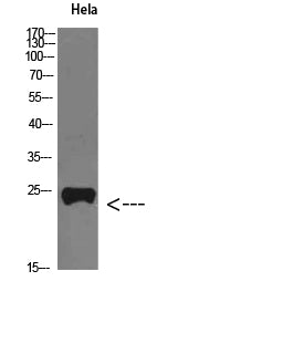PTH-rP Rabbit Polyclonal Antibody