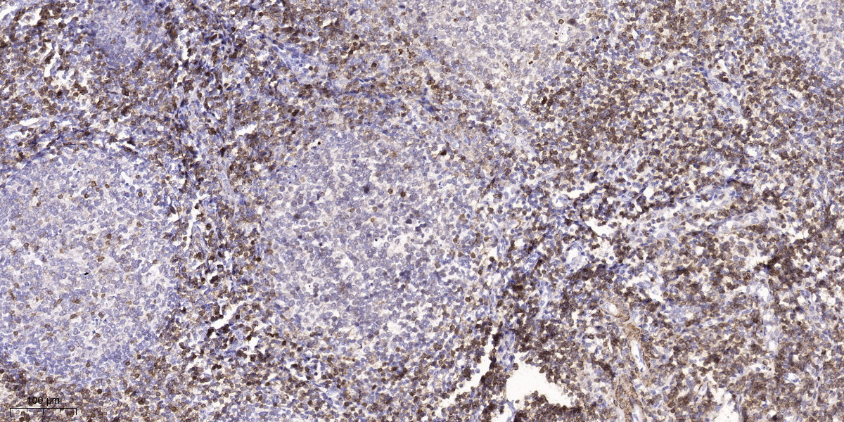 PTN13 Rabbit Polyclonal Antibody