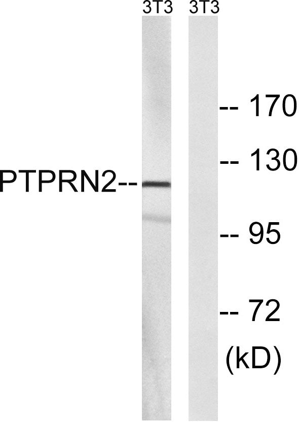 PTP IA-2β Rabbit Polyclonal Antibody