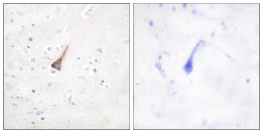 PTP1B Rabbit Polyclonal Antibody