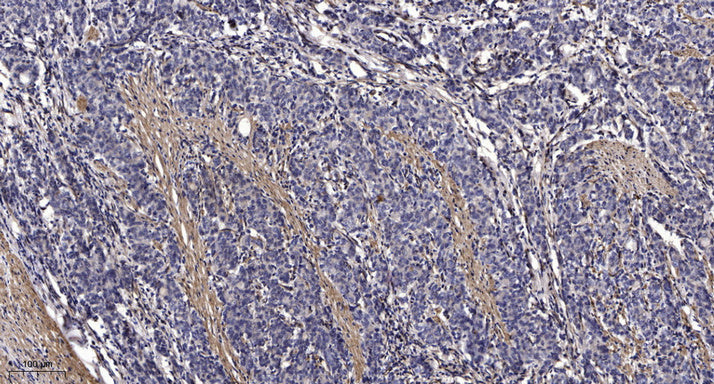 PTP22 Rabbit Polyclonal Antibody