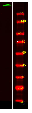 PTPRB Rabbit Polyclonal Antibody