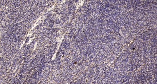 PTPα Rabbit Polyclonal Antibody