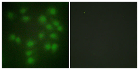 PTTG1/2/3 Rabbit Polyclonal Antibody