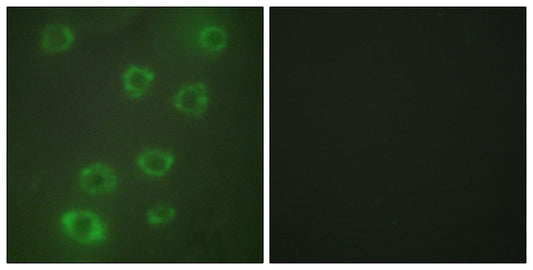 Ptx3 Rabbit Polyclonal Antibody