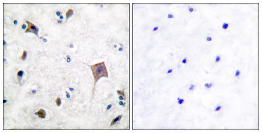 PYK2 Rabbit Polyclonal Antibody
